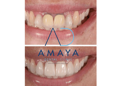 Best Dental Clinic in Bangalore | Top Dentist Bangalore