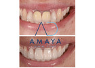 Best Dental Clinic in Bangalore | Top Dentist Bangalore